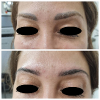 Laser Tattoo Removal-F.Houshidari,MD_16