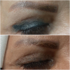 Laser Tattoo Removal-F.Houshidari,MD_30