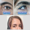 Laser Tattoo Removal-F.Houshidari,MD_78