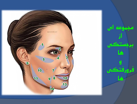 تزریق ژل و کانتورینگ صورت