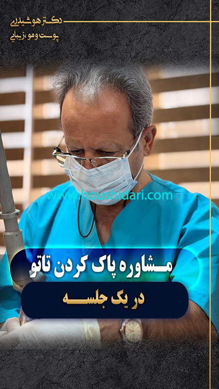 مشاوره پاک کردن تاتو در یک جلسه