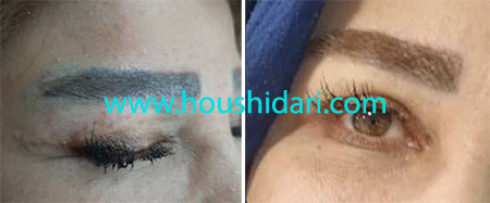 پاک کردن تاتو ابرو چند لایه