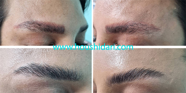 پاک کردن تاتو ابرو در یک جلسه