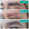 پاک کردن تاتوی ابرو_1